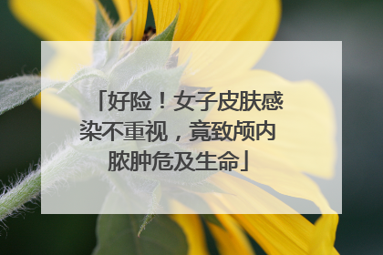 好险！女子皮肤感染不重视，竟致颅内脓肿危及生命